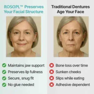 🌎Ends Today: 70% OFF! Custom-Fit Full Functional DenturesMake you more confident✨