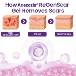 Acezozla® ReGenScar Stem Cell Scar Gel