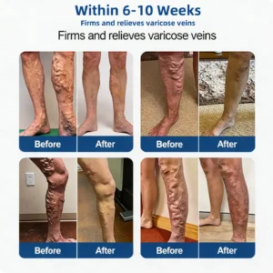 Alisanda® Vein Relief Patch｜Smoother-Looking Legs