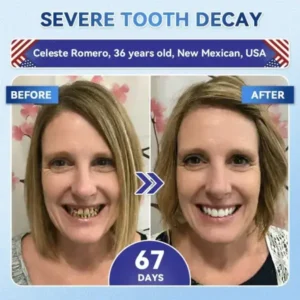 Your Smile~ SmileFitPro® 🦷 Tideglusib Fast‑Dissolving Tooth & Gum Repair Oral Strips ✨ (𝟓-𝐢𝐧-𝟏 💎 𝐑𝐞𝐛𝐮𝐢𝐥𝐝 𝐄𝐧𝐚𝐦𝐞𝐥 & 𝐃𝐞𝐧𝐭𝐢𝐧 • 𝐒𝐭𝐫𝐞𝐧𝐠𝐭𝐡𝐞𝐧 𝐆𝐮𝐦𝐬 • 𝐄𝐫𝐚𝐝𝐢𝐜𝐚𝐭𝐞 𝐓𝐚𝐫𝐭𝐚𝐫 & 𝐎𝐝𝐨𝐫 • 𝐖𝐡𝐢𝐭𝐞𝐧𝐢𝐧𝐠 • 𝐒𝐭𝐨𝐩 𝐓𝐨𝐨𝐭𝐡 𝐒𝐞𝐧𝐬𝐢𝐭𝐢𝐯𝐢𝐭𝐲)