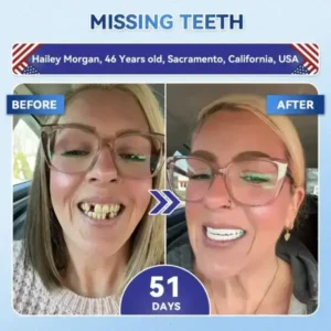 Your Smile~ SmileFitPro® 🦷 Tideglusib Fast‑Dissolving Tooth & Gum Repair Oral Strips ✨ (𝟓-𝐢𝐧-𝟏 💎 𝐑𝐞𝐛𝐮𝐢𝐥𝐝 𝐄𝐧𝐚𝐦𝐞𝐥 & 𝐃𝐞𝐧𝐭𝐢𝐧 • 𝐒𝐭𝐫𝐞𝐧𝐠𝐭𝐡𝐞𝐧 𝐆𝐮𝐦𝐬 • 𝐄𝐫𝐚𝐝𝐢𝐜𝐚𝐭𝐞 𝐓𝐚𝐫𝐭𝐚𝐫 & 𝐎𝐝𝐨𝐫 • 𝐖𝐡𝐢𝐭𝐞𝐧𝐢𝐧𝐠 • 𝐒𝐭𝐨𝐩 𝐓𝐨𝐨𝐭𝐡 𝐒𝐞𝐧𝐬𝐢𝐭𝐢𝐯𝐢𝐭𝐲)