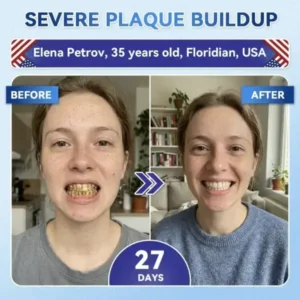 Your Smile~ SmileFitPro® 🦷 Tideglusib Fast‑Dissolving Tooth & Gum Repair Oral Strips ✨ (𝟓-𝐢𝐧-𝟏 💎 𝐑𝐞𝐛𝐮𝐢𝐥𝐝 𝐄𝐧𝐚𝐦𝐞𝐥 & 𝐃𝐞𝐧𝐭𝐢𝐧 • 𝐒𝐭𝐫𝐞𝐧𝐠𝐭𝐡𝐞𝐧 𝐆𝐮𝐦𝐬 • 𝐄𝐫𝐚𝐝𝐢𝐜𝐚𝐭𝐞 𝐓𝐚𝐫𝐭𝐚𝐫 & 𝐎𝐝𝐨𝐫 • 𝐖𝐡𝐢𝐭𝐞𝐧𝐢𝐧𝐠 • 𝐒𝐭𝐨𝐩 𝐓𝐨𝐨𝐭𝐡 𝐒𝐞𝐧𝐬𝐢𝐭𝐢𝐯𝐢𝐭𝐲)